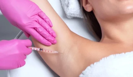 Что такое гипергидроз и как его лечить ботоксом: эффективное решение проблемы избыточного потоотделения