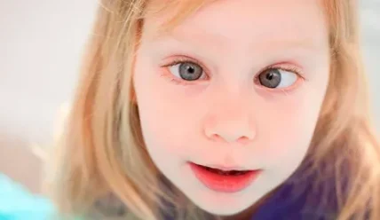 Лечение косоглазия: современные методы и подходы