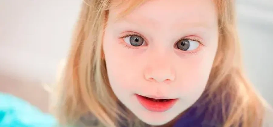 Лечение косоглазия: современные методы и подходы