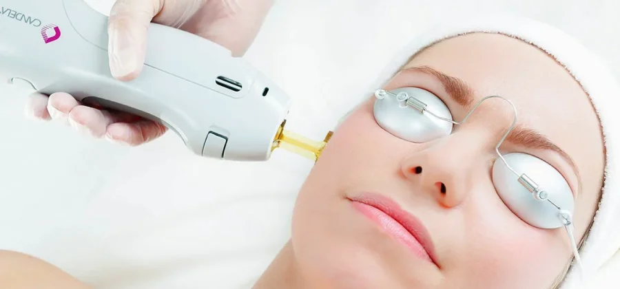 Лазерное омоложение: когда пора начинать и какие результаты ожидать