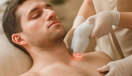Лазерная эпиляция для мужчин: зоны обработки, влияние плотности волос и нюансы курса
