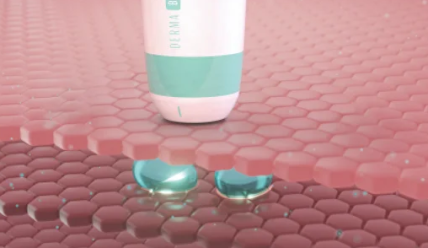 Ultraformer MPT: революция в мире SMAS-лифтинга — быстро, безболезненно, эффективно