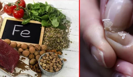 Симптомы дефицита железа: 10 признаков, которые нельзя игнорировать