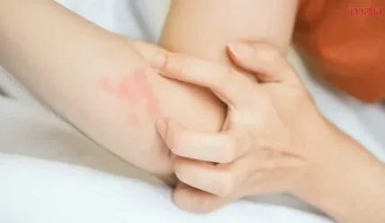 Почему тело начинает чесаться от переживаний и где искать кнопку «стоп»