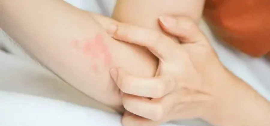 Почему тело начинает чесаться от переживаний и где искать кнопку «стоп»