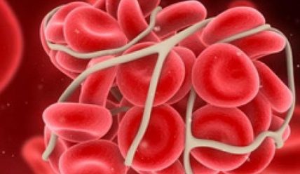 Концентрат тромбоцитов: показания к проведению трансфузий и правила безопасного выполнения