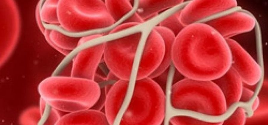 Концентрат тромбоцитов: показания к проведению трансфузий и правила безопасного выполнения