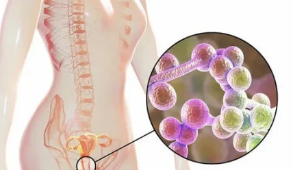 Сладкая жизнь и молочница: почему диета важна для женского здоровья