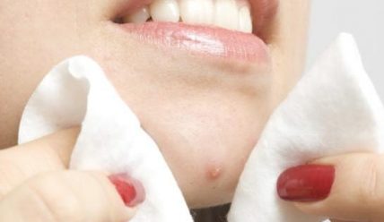 Давить ли прыщи: опасно это или нет?