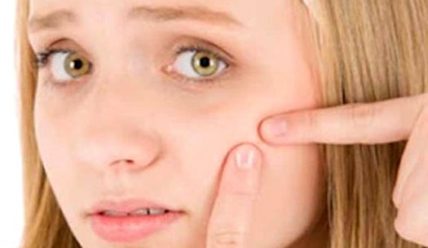 Прыщи на щеках у женщин: как избавиться?